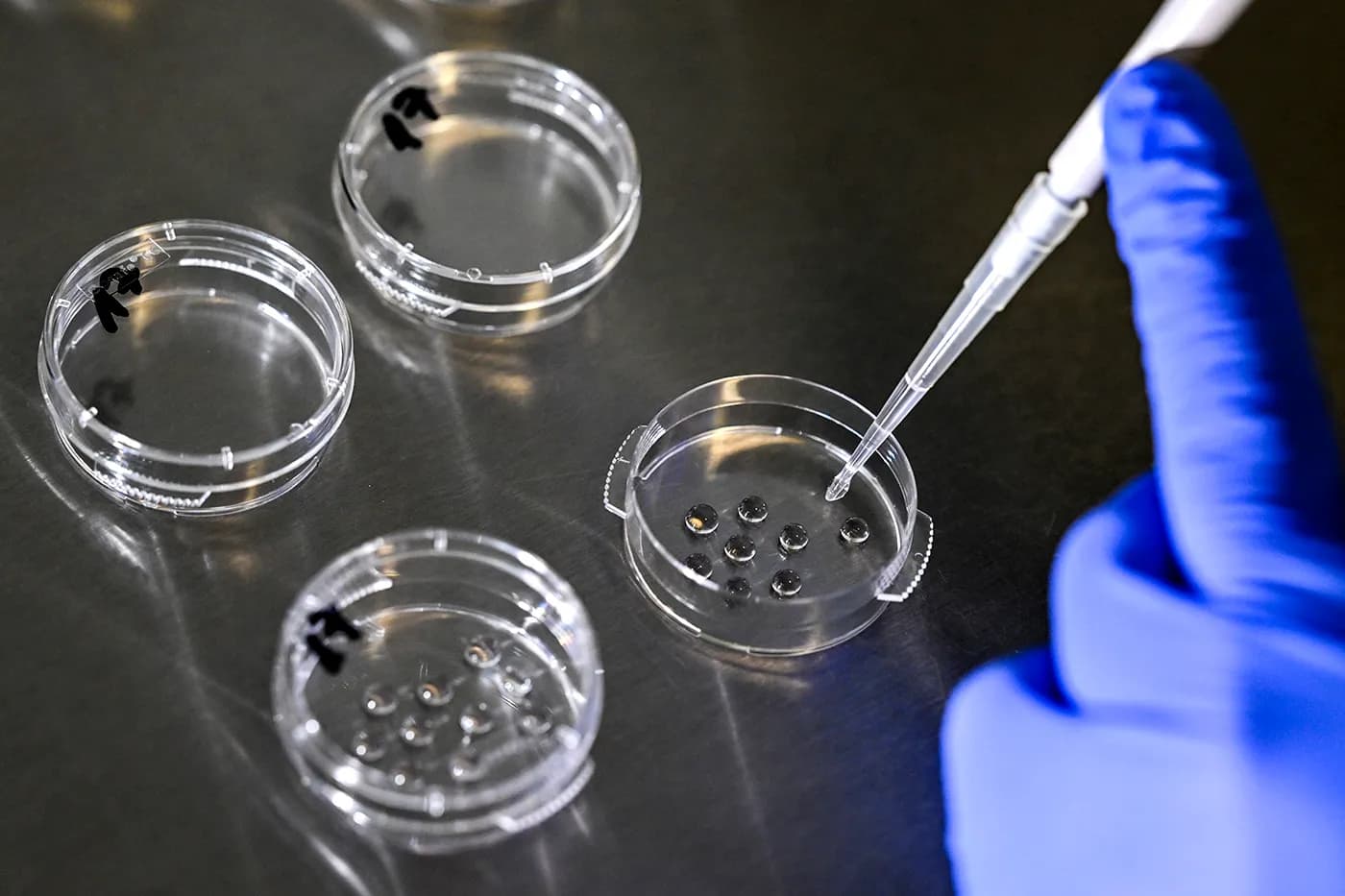 INVO Fertility Hisseleri Hissedar Onayının Ardından %64 Yükseldi